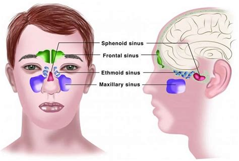 catarrh definition  symptoms diagnosis treatment
