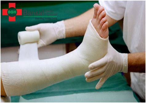 care   fracture   care   fracture