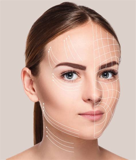 thread face lift sydney  surgical thread lifts dr adam najem