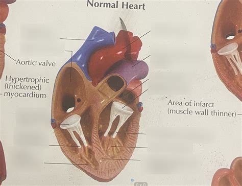 heart disease normal diagram quizlet