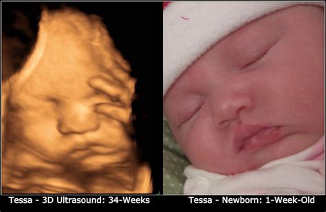 when is the best time to get 3d ultrasound pictures - Classie Berryman