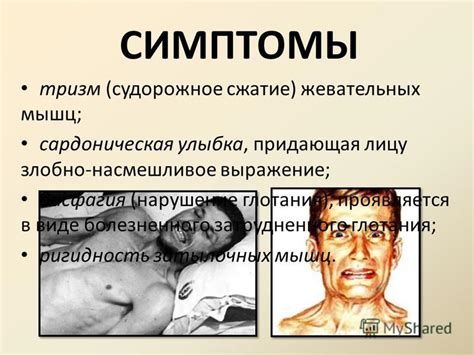 Презентация на тему: "Столбняк кратко". Скачать бесплатно и без ...