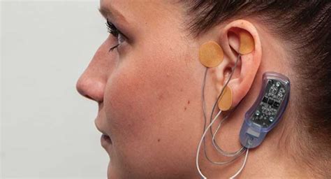 Neurostimulation Devices Are Advanced Medical Devices, Used For ...