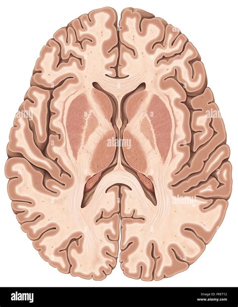 Transverse Brain Anatomy