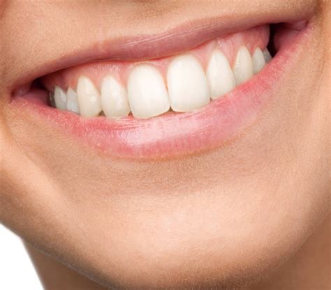 Polo Dental | Full-mouth-Debridement