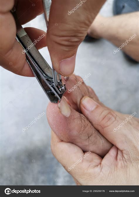 Close Scene Person Cutting Hand Toe Nails — Stock Photo © sweemingyoung