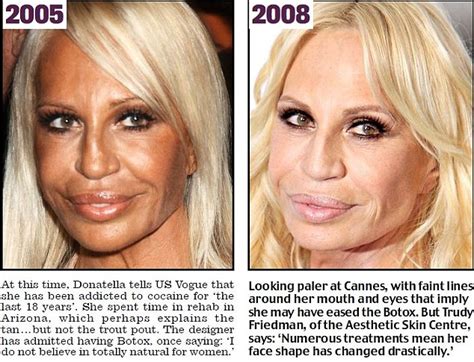 How Donatella Versace transformed herself into a human waxwork | Daily ...