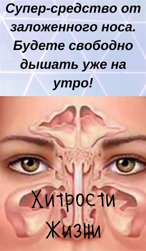Супер-засіб від закладеного носа. Будете вільно дихати вже на ранок ...