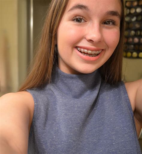 Braces Girls, Crooked Teeth, Teen Girl, Men's Fashion, Photography