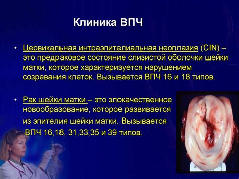 Специфические воспалительные заболевания женских половых органов ...