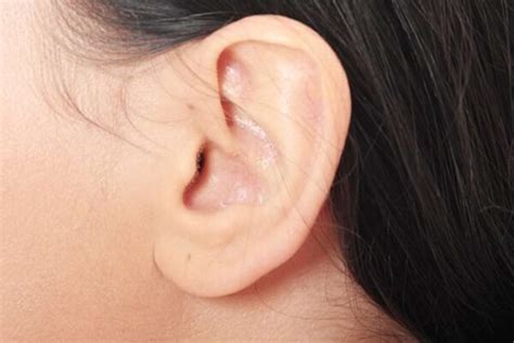 understand  genetics   types  earlobes