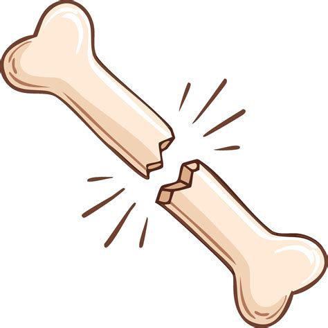 Fractured Bone Cartoon Illustration, Broken Human Limb, Medical Injury