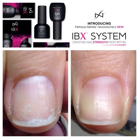 IBX System (26 pics): what is it? Step-by-step instructions for ...