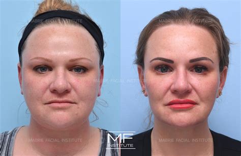 InfluencerGoneWild's Unexpected Journey: Before & After Photos. Image 18