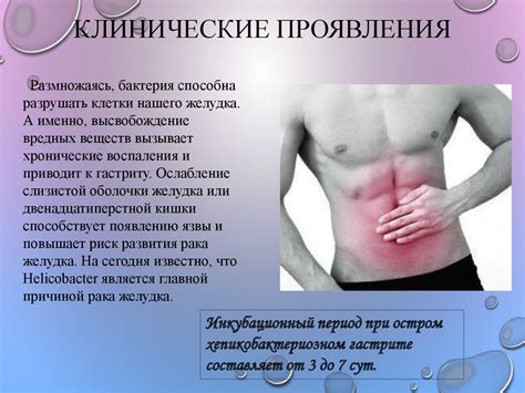 Бактерия Helicobacter pylori - презентация онлайн