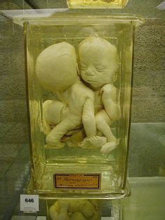 mutter museum