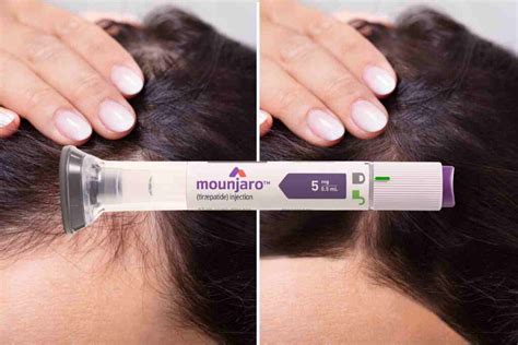 Mounjaro Cai O Cabelo - Helpful Mounjaro Hair Loss Info For Anyone Taking GLP-1