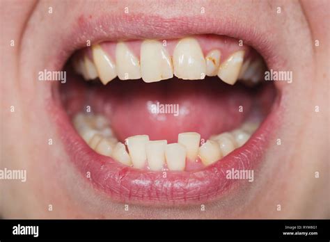Tongue and lips -Fotos und -Bildmaterial in hoher Auflösung – Alamy