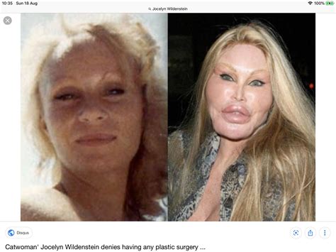 Jocelyn Wildenstein Before