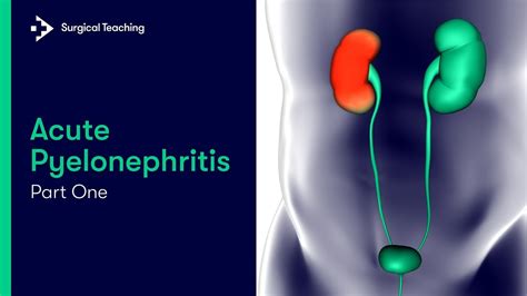 Acute Pyelonephritis | What is it and What Causes it? - YouTube