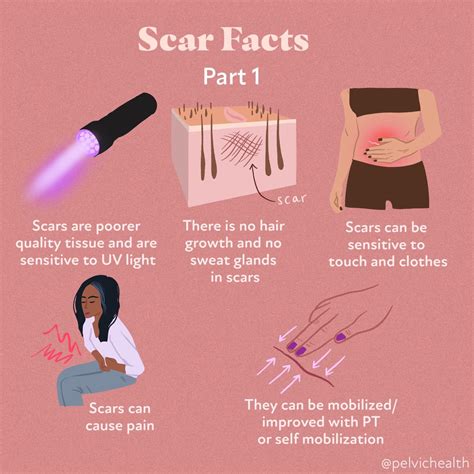 Scar Facts: All You Need to Know for Healing | PHRC