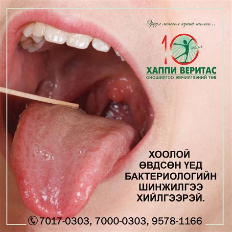 👉Бактериологийн шинжилгээ өгөхөд юуг анхаарах вэ⁉️ Бактериологийн ...