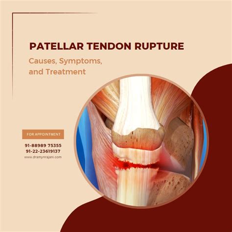 patellar tendon rupture  symptoms  treatment