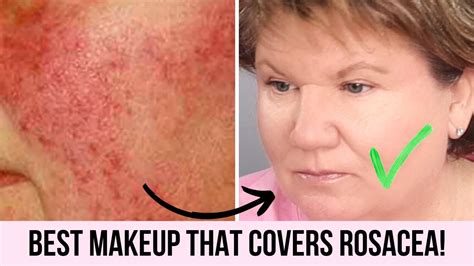 makeup  rosacea saubhaya makeup