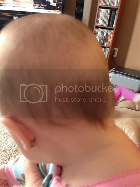 HELP! Strange lump on back of head?! *pic* - BabyCenter