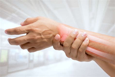 HAND & WRIST – Nova Ortho and Spine
