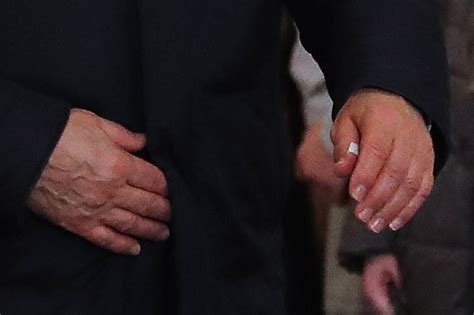 Песков раскрыл "тайну" перевязанного пальца Путина (ФОТО) - TOPNews.RU