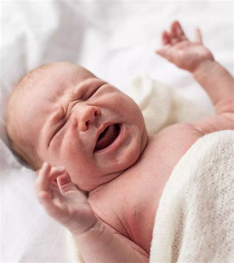 torticollis  babies  signs  treatment