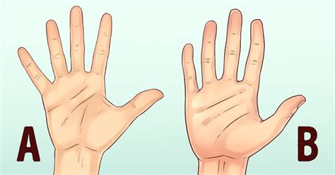 Middle Finger Is Crooked Symptoms that always occur with middle knuckle ...