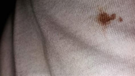 how long does it take for blood to turn brown