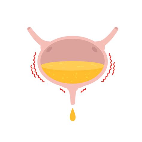 infopool | support for sexual problems