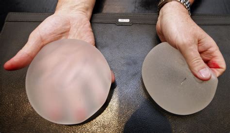 Implants mammaires PIP: Vent de scandale
