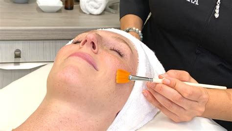 Peeling médical (facial) - Institut Figurra