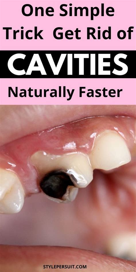 7 Magic Tricks For Healing Tooth Cavities Without The Dentist