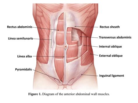 An overview of the management of diastasis of the rectus abdominal