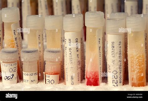 Frozen blood samples used in research study Stock Photo - Alamy