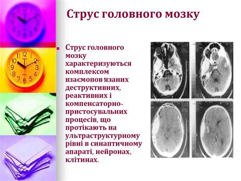 Травми голови та головного мозку - презентация онлайн