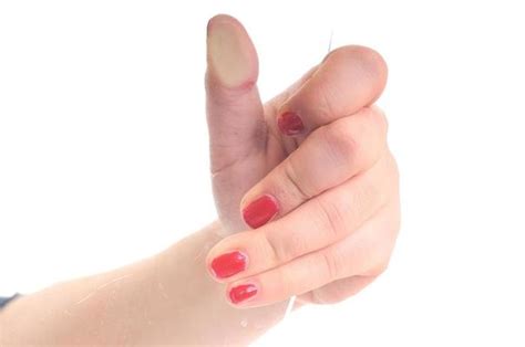 Bleeding Hand Stock Photos, Images and Backgrounds for Free Download