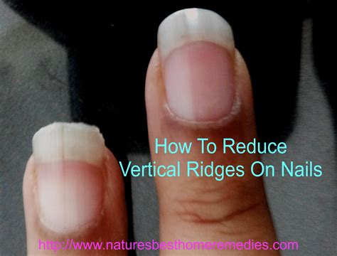 Why Vertical Nail Ridges - Design Talk