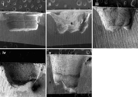 Representative scanning electron micrograph of resultant cavities from ... 
