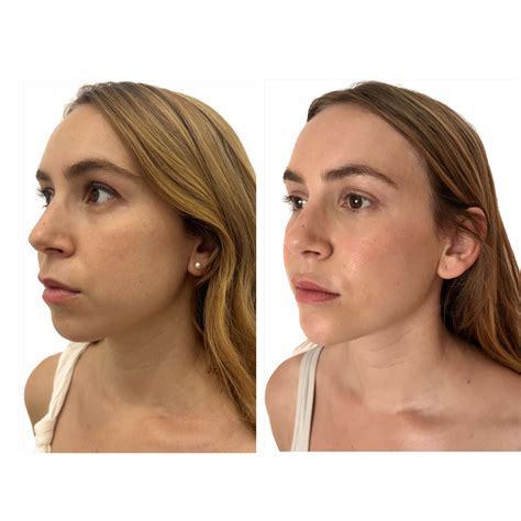 Contorno De Rostro Humano