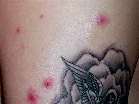 what does a infected cut look like 1