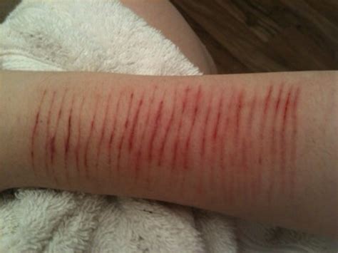 cutting  arm quotes quotesgram