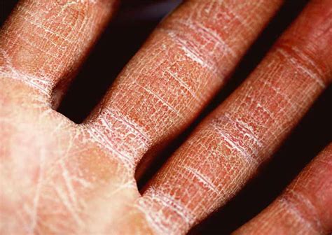 how to know if your skin is dehydrated