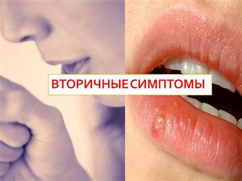 Первые признаки вич у мужчин через сколько проявляются симптомы и ...