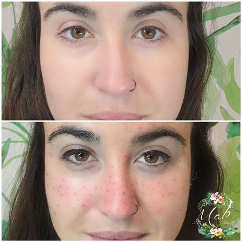 tatuaje de pecas mabtatto studio